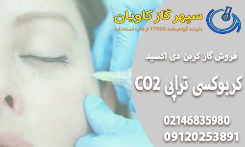کربن دی اکسید-سپهر گاز کاویان